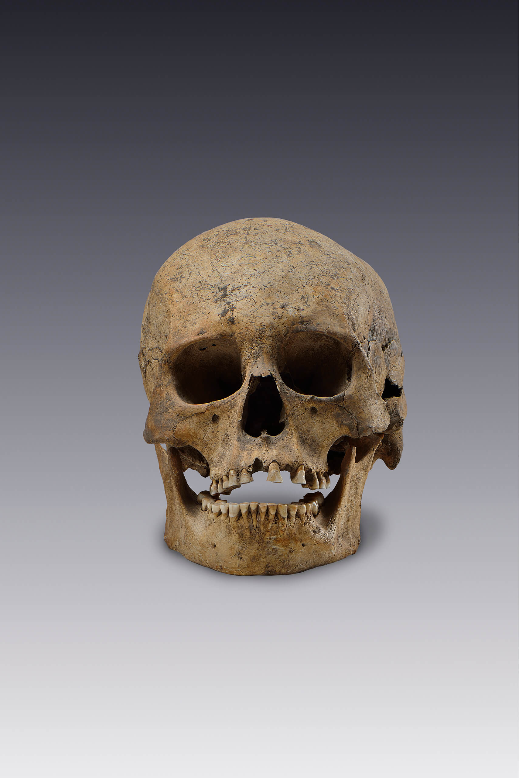 Cráneos humanos | El México antiguo. Salas de Arte Prehispánico | Museo Amparo, Puebla