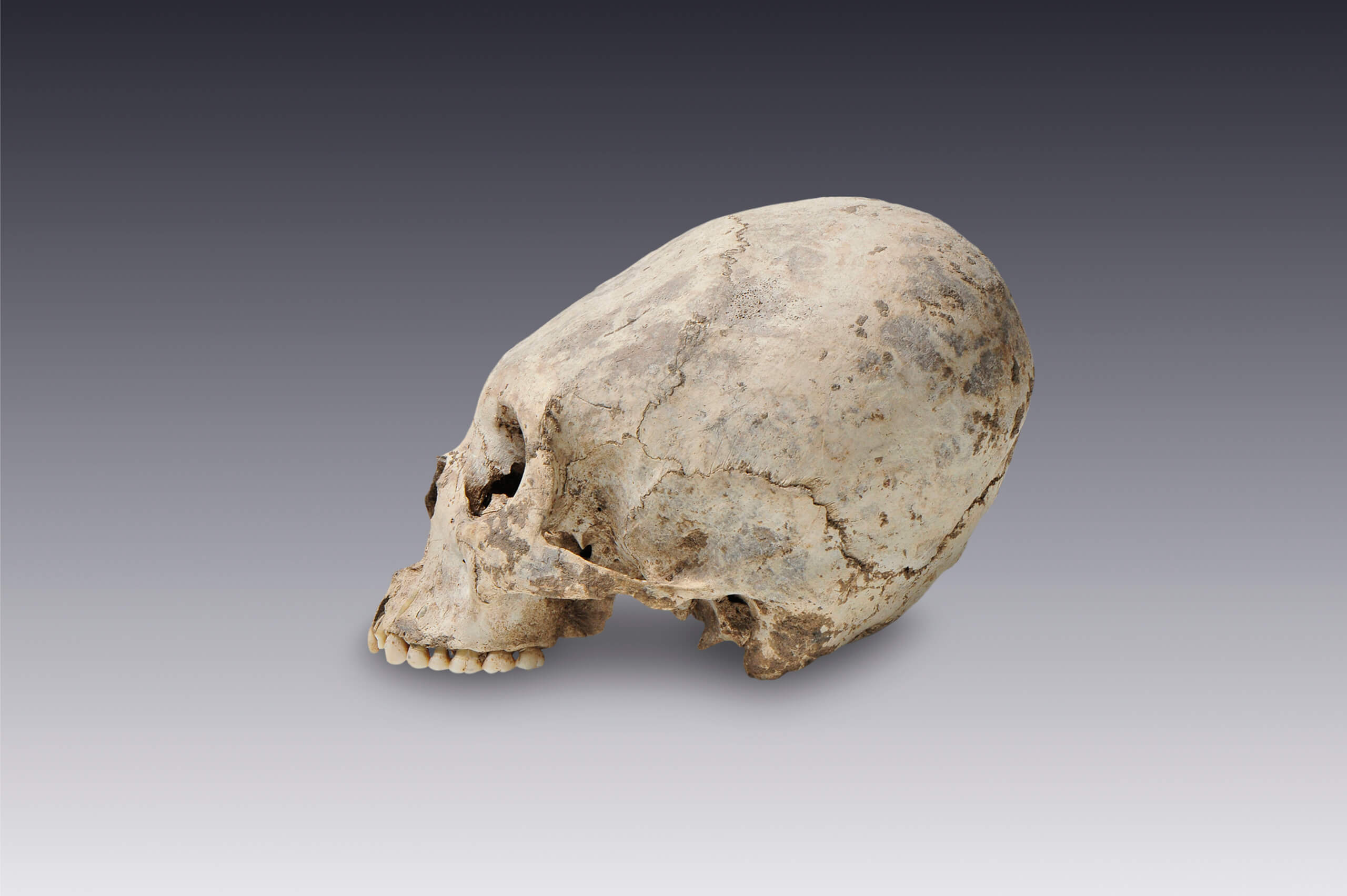 Cráneo con deformación intencional | El México antiguo. Salas de Arte Prehispánico | Museo Amparo, Puebla
