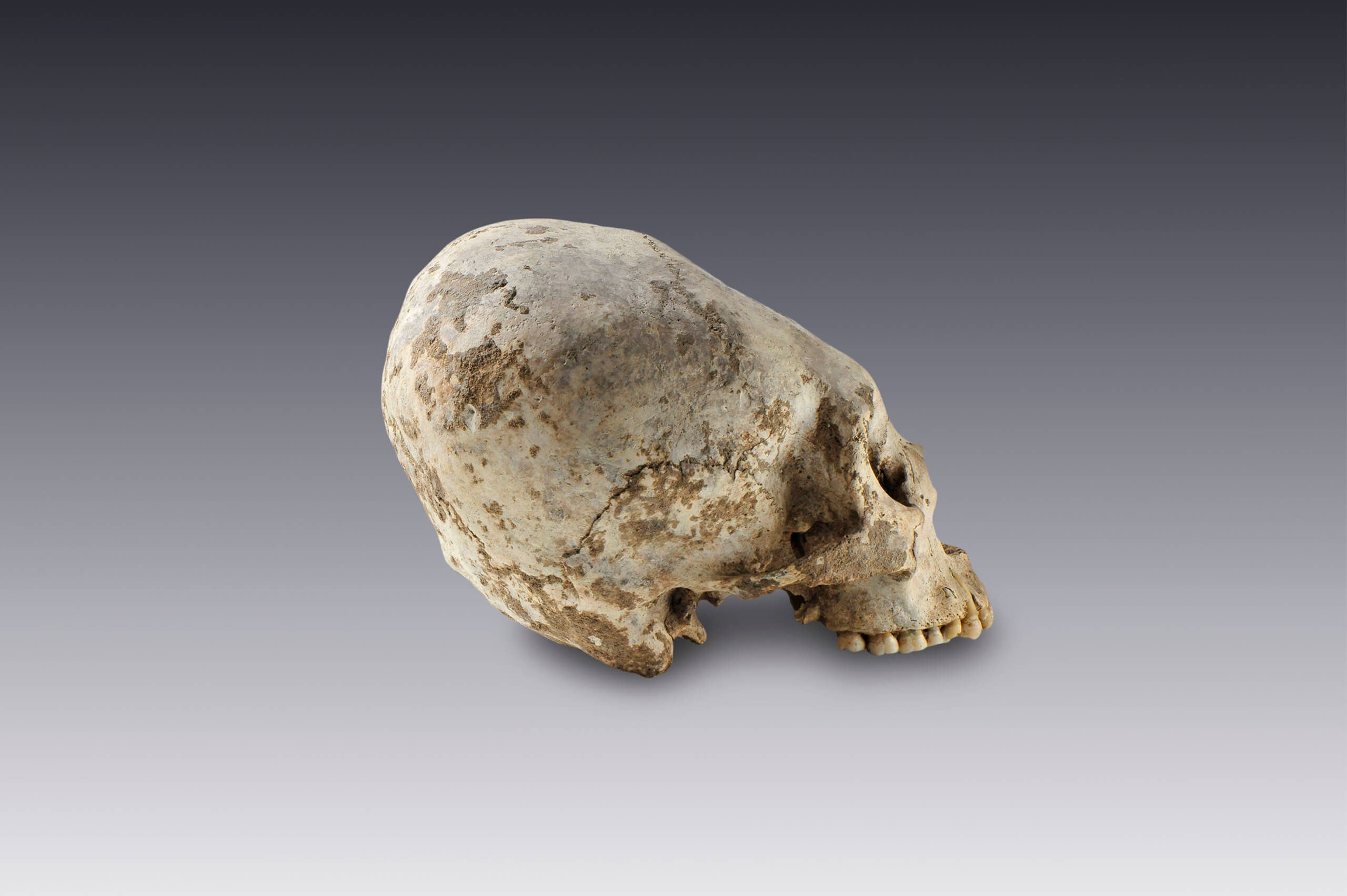 Cráneo con deformación intencional | El México antiguo. Salas de Arte Prehispánico | Museo Amparo, Puebla